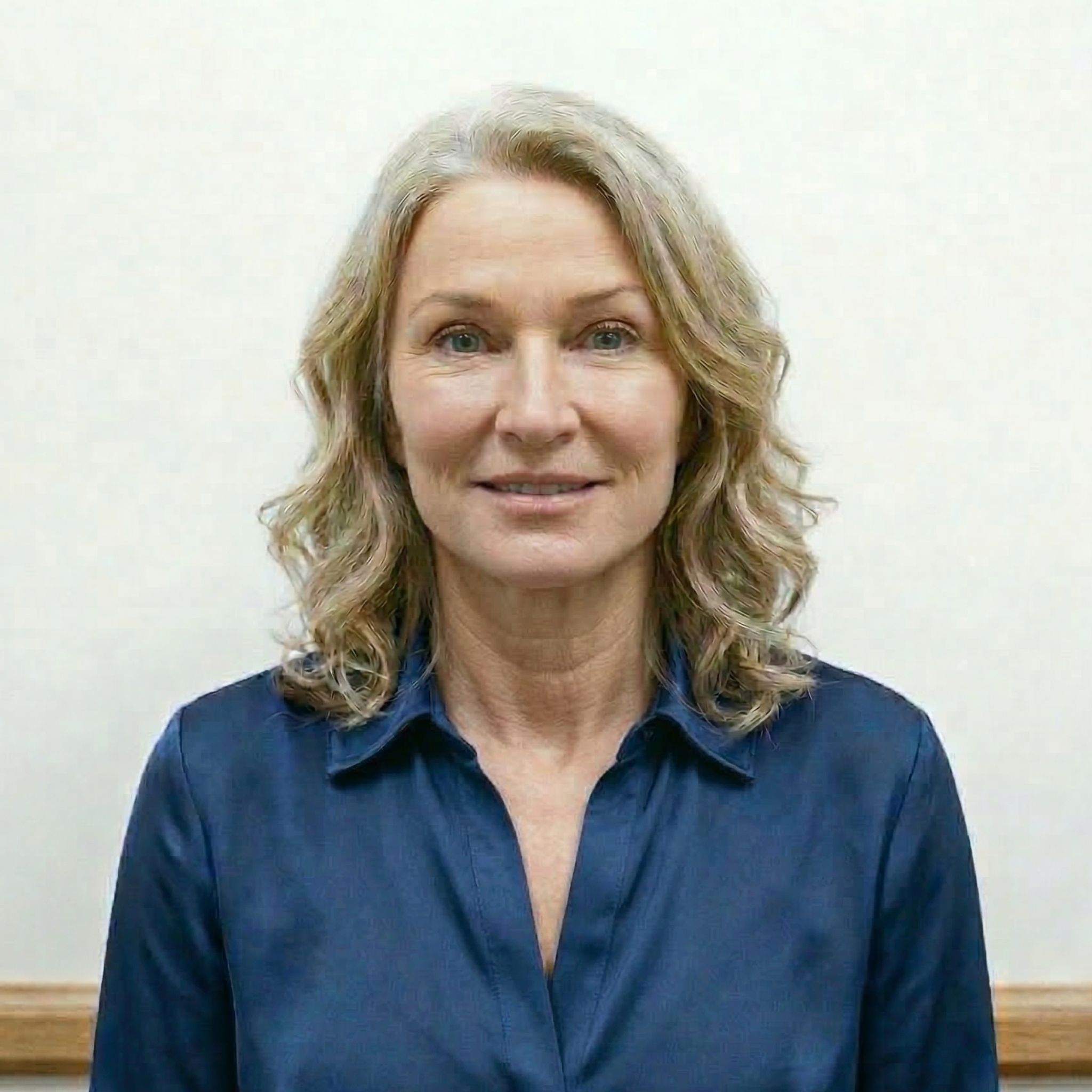 Nachher – Ergebnis nach dem Mini-SMAS-Facelift